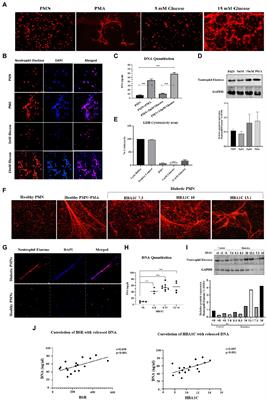 Spontaneous NETosis in diabetes: A role of hyperglycemia mediated ROS and autophagy